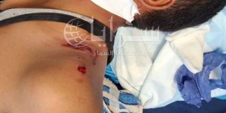 صور تقشعر لها الأبدان .. طفل يتعرض لهجوم من كلاب ضالة أمام طوارئ مستشفى البادية الشمالية - بوابة فكرة وي