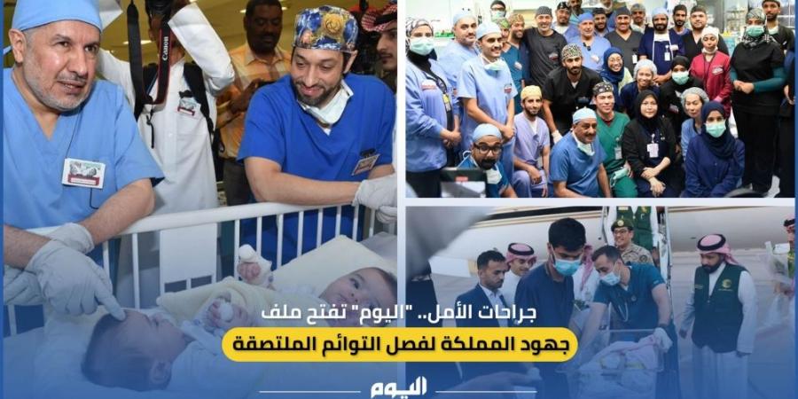 جراحات الأمل.. "اليوم" تفتح ملف جهود المملكة لفصل التوائم الملتصقة - بوابة فكرة وي